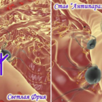 Parasites of the physical body. Posted By: Gella
